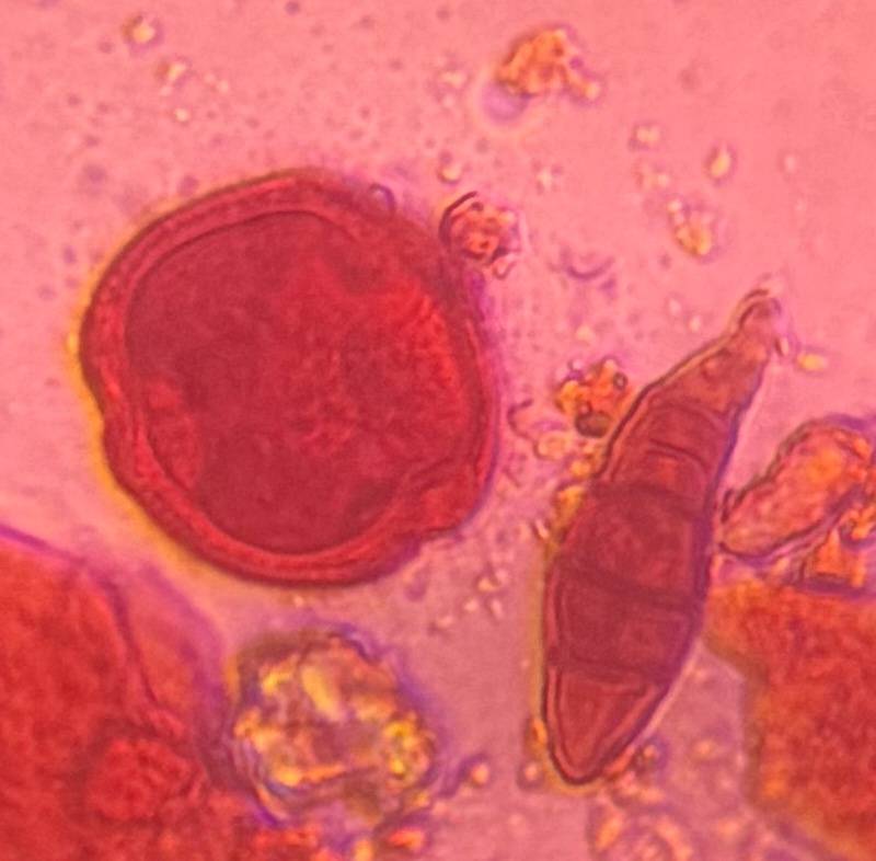 Microscope image of Oak — pollen (gallery) — verified by PollyMap
