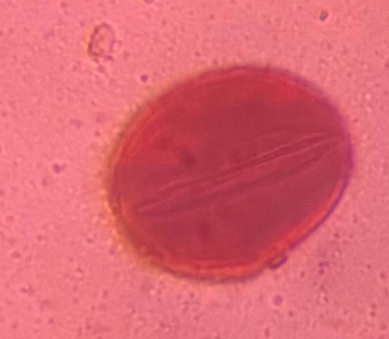 Microscope image of Oak — pollen (gallery) — verified by PollyMap