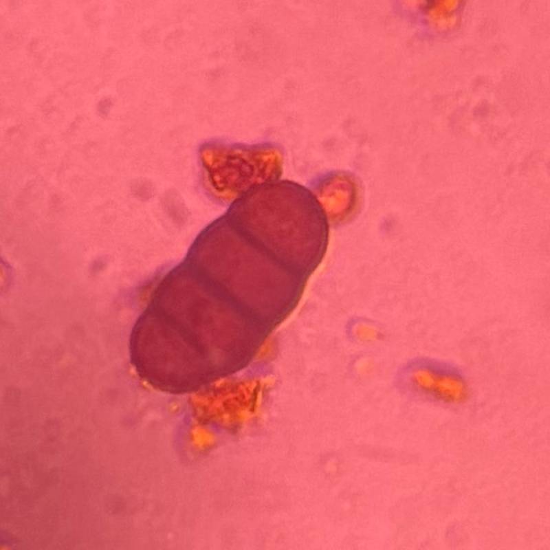 Microscope image of Curvularia — mold (reference) — verified by PollyMap
