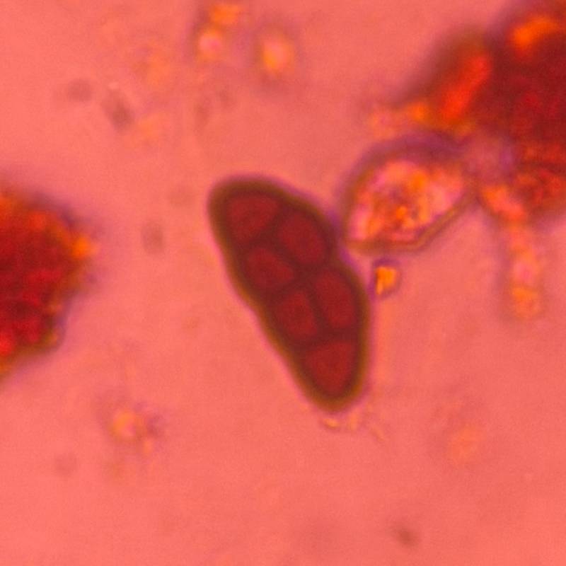 Microscope image of Pithomyces — mold (gallery) — verified by PollyMap