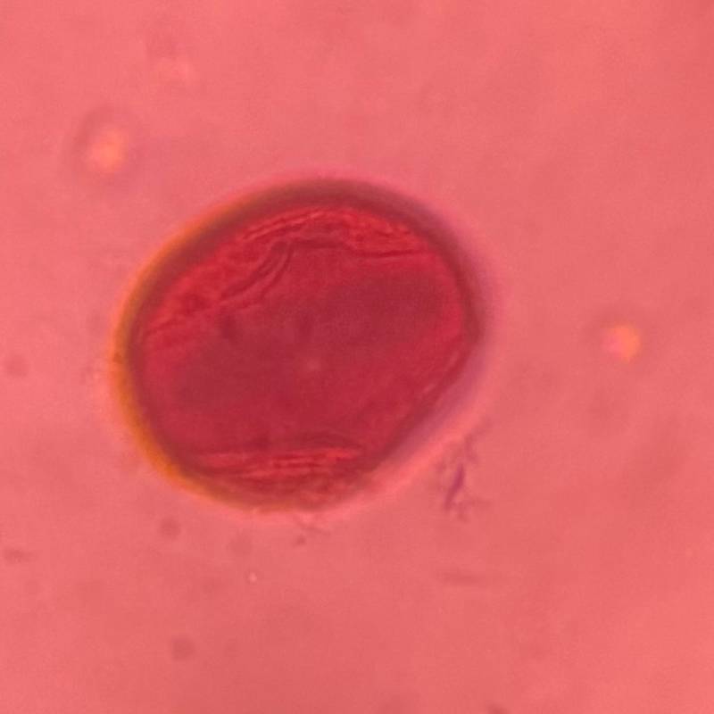 Microscope image of Oak — pollen (reference) — verified by PollyMap