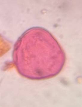 Microscope image of Poaceae — pollen (reference) — verified by PollyMap