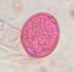 Microscope image of Celtis — pollen (gallery) — verified by PollyMap