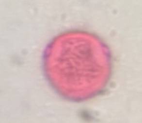 Microscope image of Celtis — pollen (gallery) — verified by PollyMap