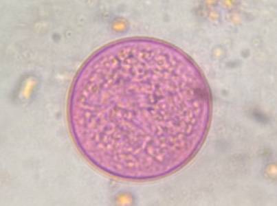 Microscope image of Poaceae — pollen (gallery) — verified by PollyMap