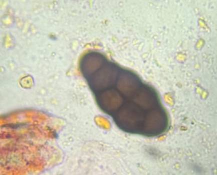 Microscope image of Pithomyces — mold (gallery) — verified by PollyMap