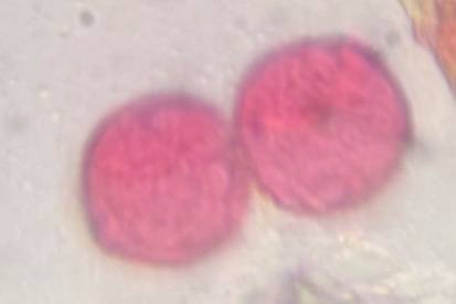 Microscope image of Celtis — pollen (reference) — verified by PollyMap