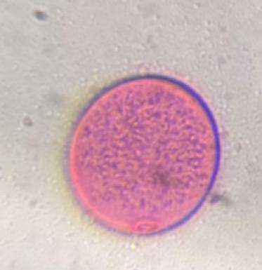 Microscope image of Poaeceae — pollen (reference) — verified by PollyMap