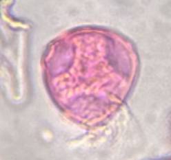 Microscope image of Celtis — pollen (gallery) — verified by PollyMap