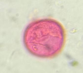 Microscope image of Poaceae — pollen (gallery) — verified by PollyMap