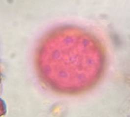 Microscope image of Chenopod — pollen (gallery) — verified by PollyMap