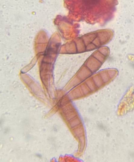 Microscope image of Alternaria — mold (reference) — verified by PollyMap