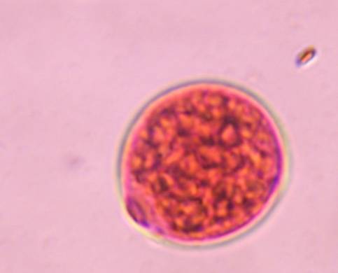 Microscope image of Poaceae — pollen (gallery) — verified by PollyMap