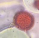 Microscope image of Astereacea — pollen (reference) — verified by PollyMap