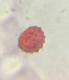 Microscope image of Aster/Daisy (Asteraceae) — pollen (reference) — verified by PollyMap
