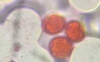 Microscope image of Sweetgum — pollen (reference) — verified by PollyMap