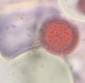 Microscope image of Asteraceae — pollen (gallery) — verified by PollyMap