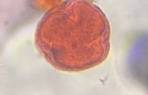 Microscope image of Oak (Quercus) — pollen (reference) — verified by PollyMap