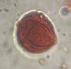 Microscope image of Maple — pollen (reference) — verified by PollyMap