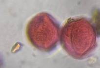 Microscope image of Oak — pollen (gallery) — verified by PollyMap
