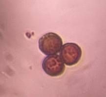 Microscope image of Epicoccum — mold (gallery) — verified by PollyMap