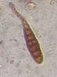 Microscope image of Alternaria — mold (gallery) — verified by PollyMap