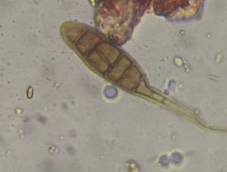 Microscope image of Alternaria — mold (gallery) — verified by PollyMap