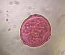 Microscope image of Mulberry — pollen (reference) — verified by PollyMap