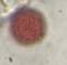 Microscope image of Chenopod — pollen (gallery) — verified by PollyMap