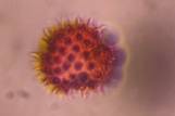 Microscope image of Asteraceae — pollen (gallery) — verified by PollyMap