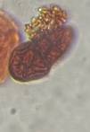Microscope image of Ulocladium — mold (gallery) — verified by PollyMap