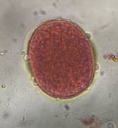 Microscope image of Grass — pollen (gallery) — verified by PollyMap