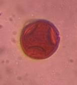 Microscope image of Hackberry — pollen (gallery) — verified by PollyMap