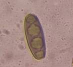 Microscope image of Bipolaris — mold (reference) — verified by PollyMap