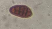 Microscope image of Ulocladium — mold (gallery) — verified by PollyMap