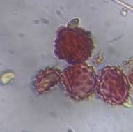 Microscope image of Asteraceae — pollen (gallery) — verified by PollyMap