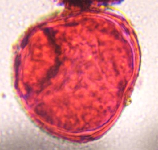 Microscope image of Unknown — pollen (reference) — verified by PollyMap