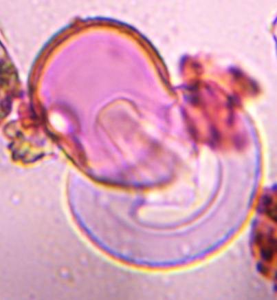 Microscope image of Juniper — pollen (gallery) — verified by PollyMap