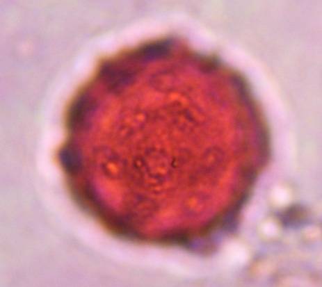 Microscope image of Chenopod — pollen (reference) — verified by PollyMap