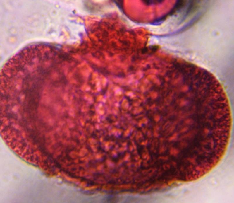 Microscope image of Pine — pollen (gallery) — verified by PollyMap