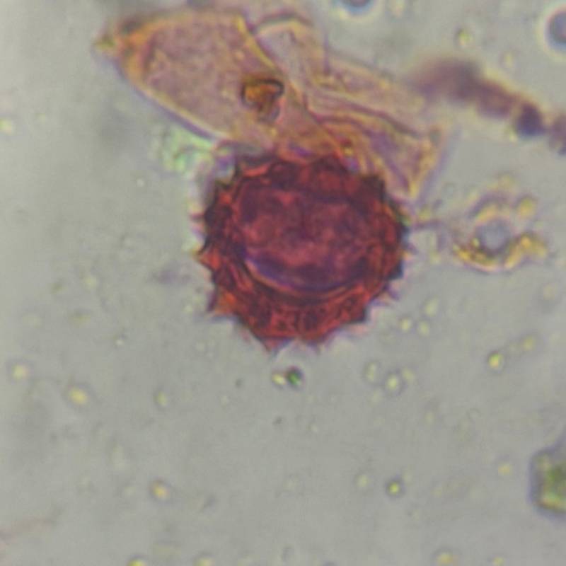Microscope image of Sunflower family (Asteraceae) — pollen (reference) — verified by PollyMap