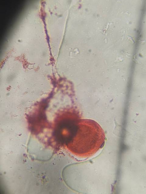 Microscope image of Corn (Zea mays) — pollen (reference) — verified by PollyMap