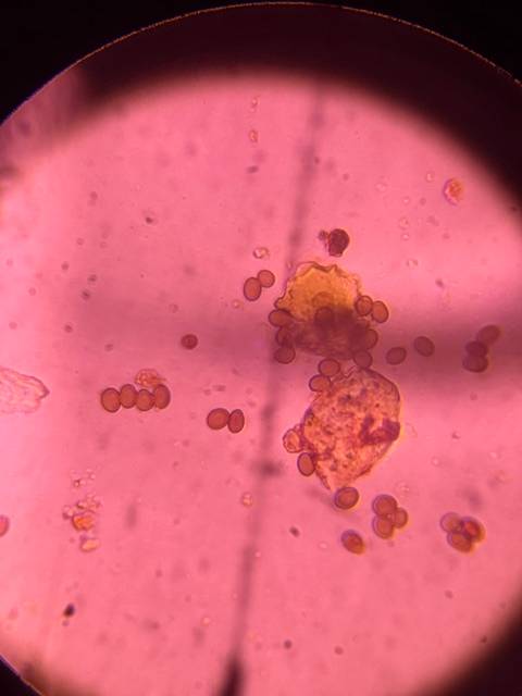 Microscope image of Smut spores (Ustilaginales) — mold (reference) — verified by PollyMap