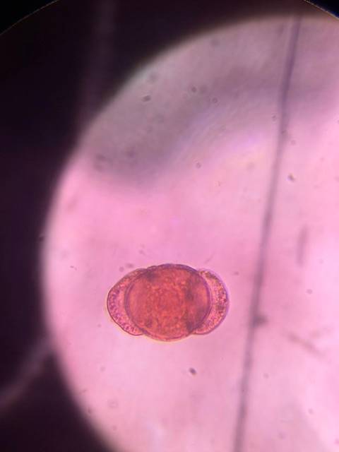 Microscope image of Pine (Pinus spp.) — pollen (reference) — verified by PollyMap