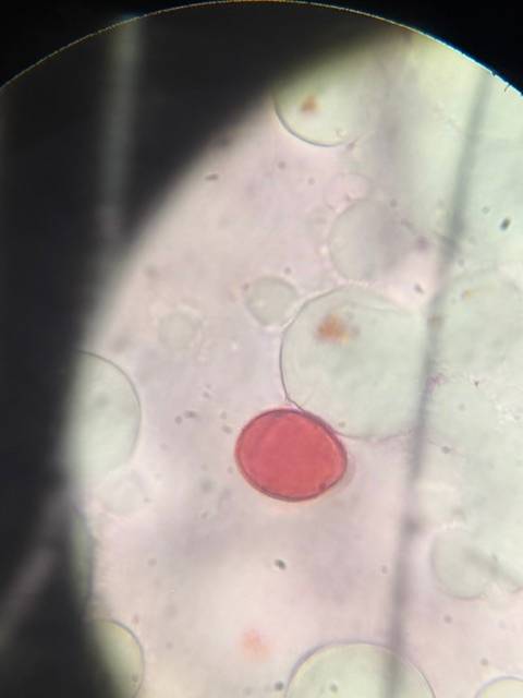 Microscope image of Unknown Pollen (possibly Grass/Poaceae) — pollen (reference) — verified by PollyMap