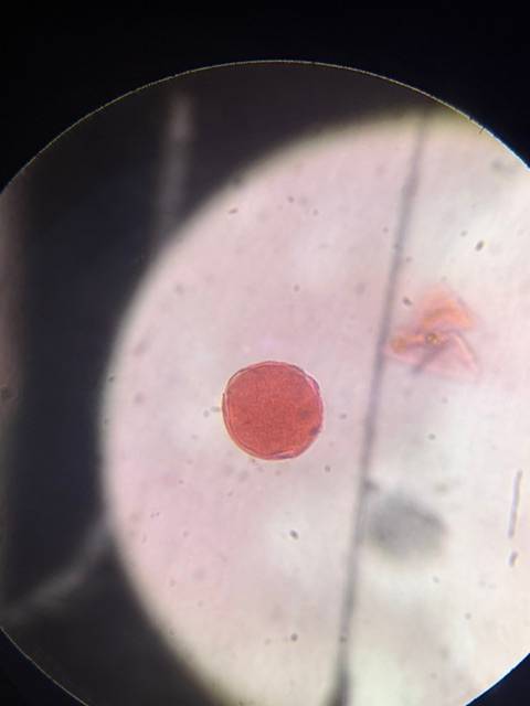 Microscope image of Elm (ulmus) — pollen (gallery) — verified by PollyMap