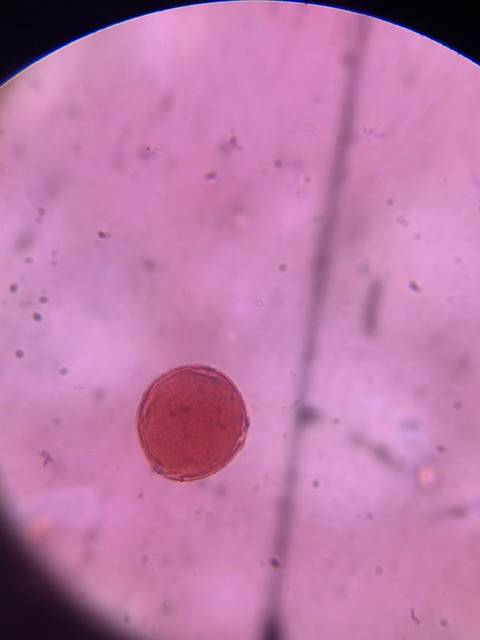 Microscope image of Elm (ulmus) — pollen (reference) — verified by PollyMap