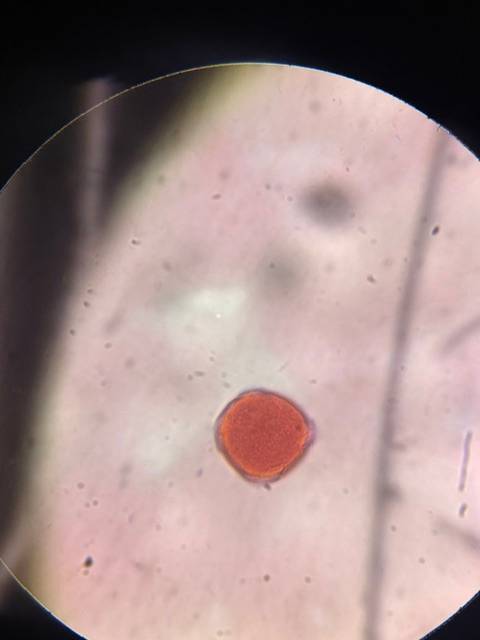 Microscope image of Elm (ulmus) — pollen (gallery) — verified by PollyMap