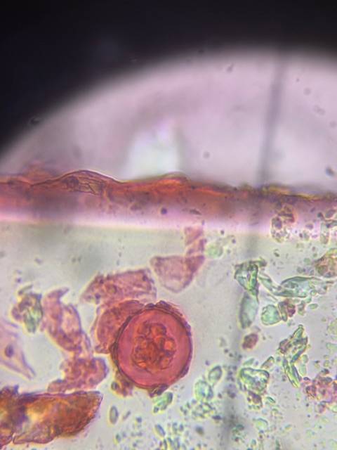 Microscope image of Unknown — pollen (gallery) — verified by PollyMap