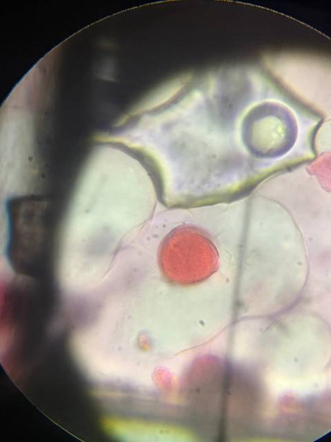 Microscope image of Oak — pollen (gallery) — verified by PollyMap
